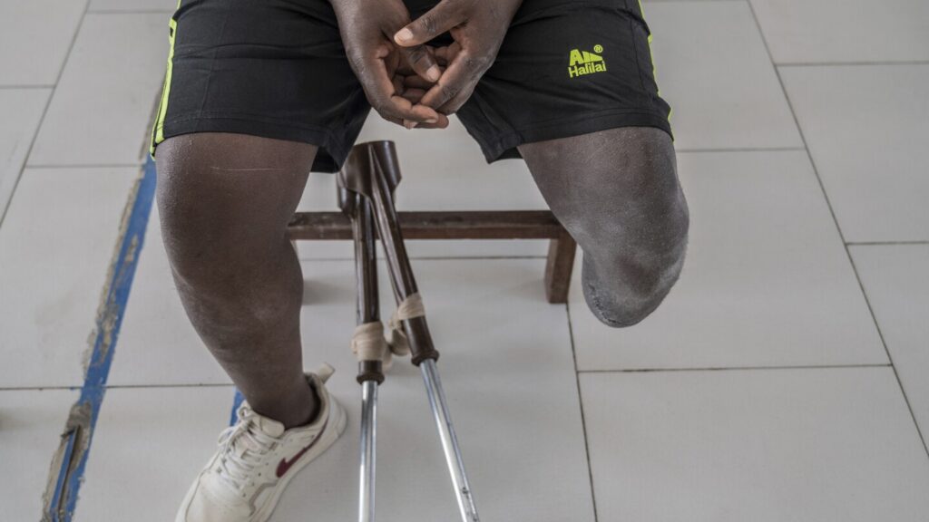 Photos of an orthopedic center in Congo that helps amputees regain mobility
