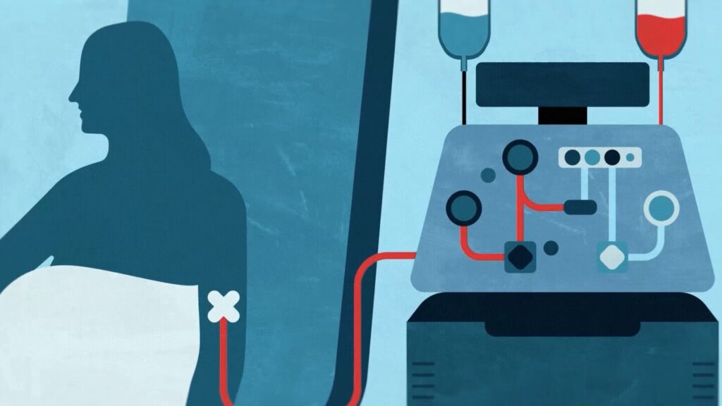 Lifelong drugs don’t solve autoimmune diseases. Researchers are trying something new