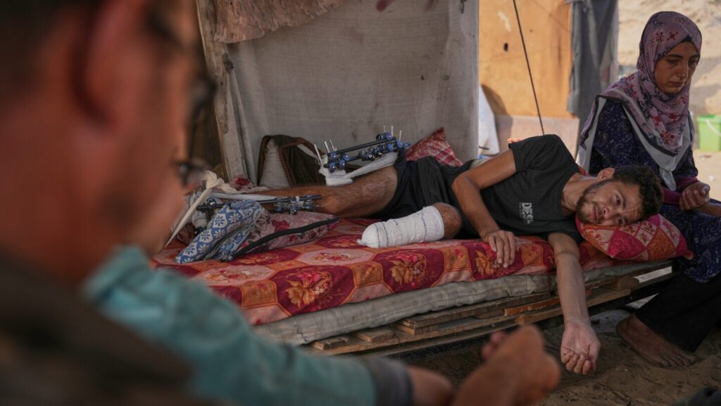 Gaza amputees’ lives on hold as strip struggles with shortage of prosthetic limbs